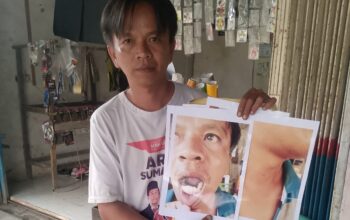 Oknum ASN Kecamatan Diduga Aniaya Warga Lubuk Jale, Korban Desak Penegakan Hukum